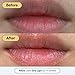 Remedy for Dry Lips | All-In-One Lip Treatment | Hydrating and Healing Lip Balm Ointment with Ceramides, Peptides, and Dimethicone | Repairs Dry, Cracked Lips | By Dermatologist Dr. Shah