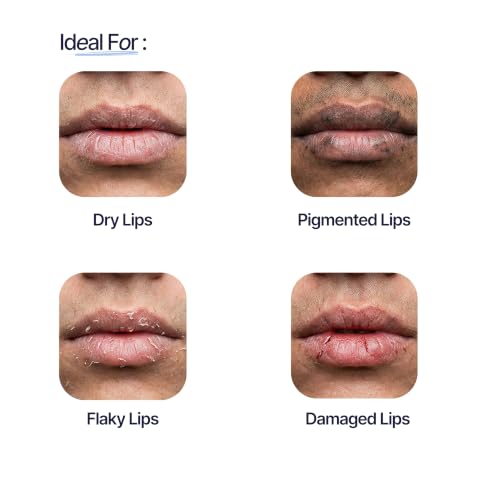Image of Mannlich Lip Balm for Men (10g) Lip Care with SPF 50 PA++++ Protection - Lip Lightening for Dark, Dry & Chapped Lips - Moisturizes, Nourishes & Softens Lips, Long-Lasting Hydration with 2% Kojic Acid & 1% Hyaluronic Acid (Pack of 4)