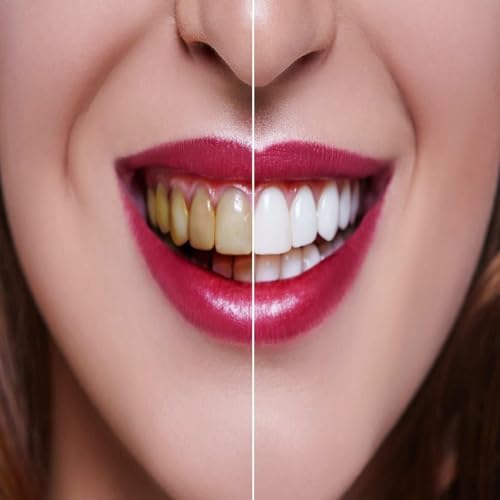 Teeth Whitening Dentist Tips for a Brighter Smile