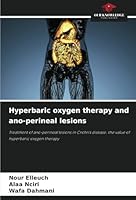 Tlenoterapia hiperbaryczna i zmiany w okolicy krocza: Leczenie zmian w okolicy krocza w chorobie Lesniowskiego-Crohna: korzysci z tlenoterapii hiperbarycznej (Polish Edition) 6208660777 Book Cover