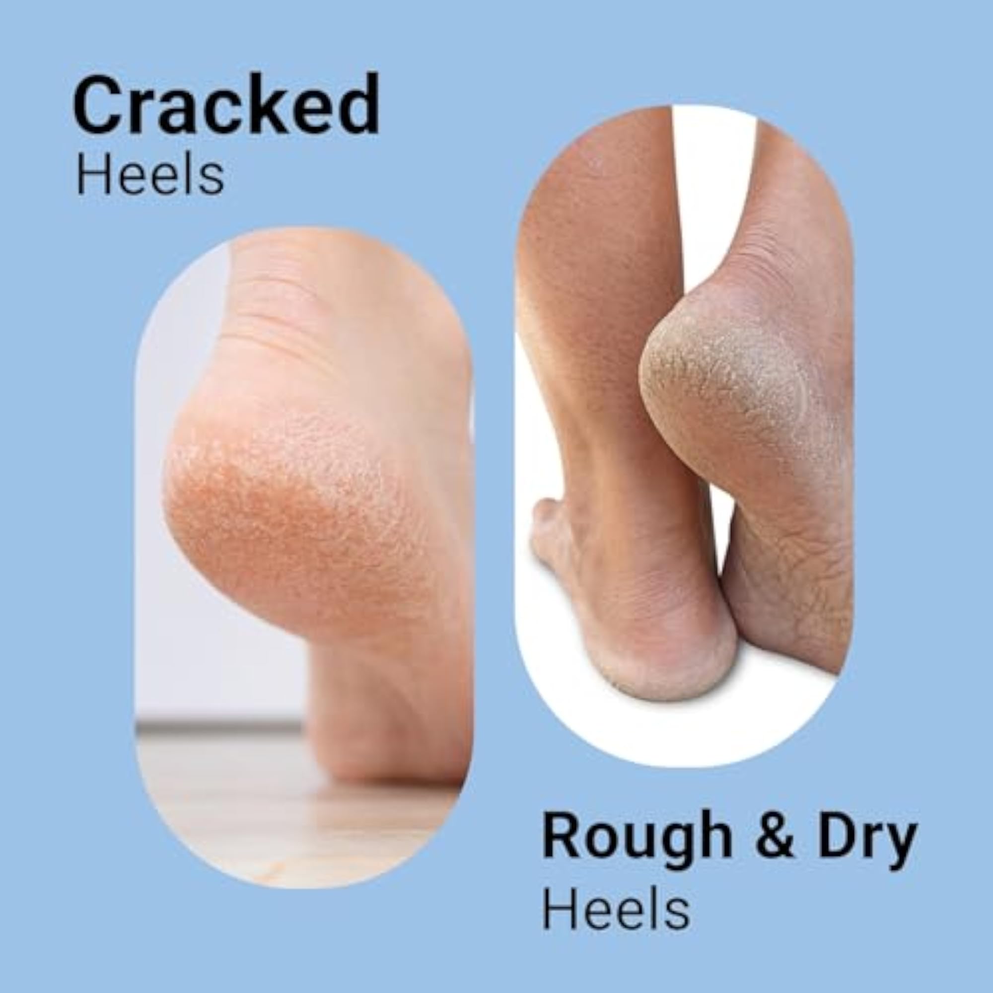 Dr. Algar Foot Roll-On & Vitamin C Serum Combo, Heel Care