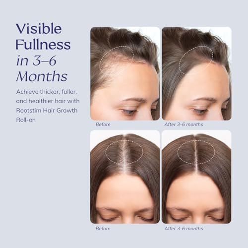 Hair Growth Serum Roll On with Rosemary, Caffeine & Biotin, Helps Support Fuller-Looking Hair, Clean Non-Greasy Scalp Serum for Thinning Hair 1.08 Fl Oz - Thumbnail 6