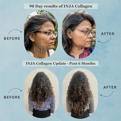 INJA PRO Marine Collagen Supplement for Women and Men for Healthy Skin, Original Japanese Collagen, Joints and Hair, No Added Sugar or Preservatives, Unflavoured Collagen... - Image 6