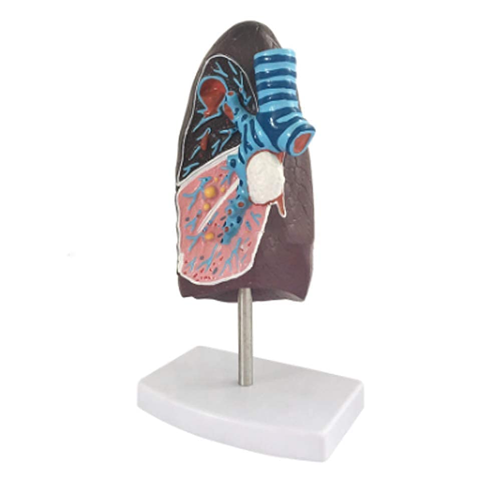 Zusammenbau-Montagemodell, Anatomie-Modell, Lungenorgan, menschliches pathologisches anatomisches Atmungssystem, Modell für Medizin, Biologie, Labor, Wissenschaft, Unterricht, Demonstration für Schul