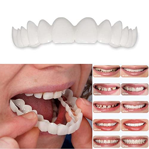 Chnlml 2 Pairs Instant Veneers Dentures For Men And Women, Customizable Temporary ​Fake Teeth, Teeth Improve Smile, Perfect Braces And Whitening Substitutes, Suitable For Everyone With, Multicolor #TOP1