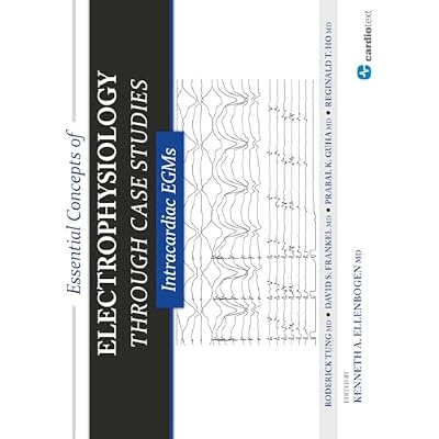 Essential Concepts of Electrophysiology Through Case Studies: Intracardiac EGMs: Intracardiac EGMs