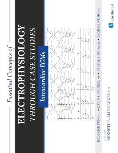 Essential Concepts of Electrophysiology Through Case Studies: Intracardiac EGMs