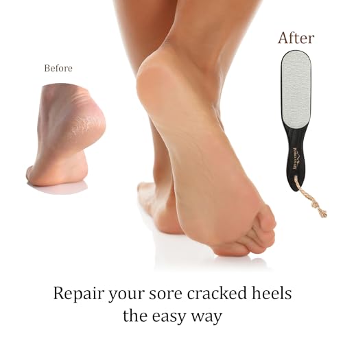 Image of Pumice Stone Foot Scrubber - Pedicure Foot File with Handle for Dry Dead Skin - Callus Remover for Feet - Foot Scraper - Exfoliating Brush for Heels, Elbows, Hands