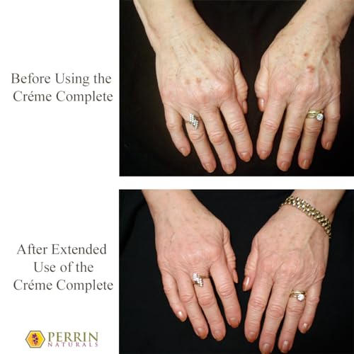 Creme Complete- All Natural, Restorative & Anti-Aging skin care. A Corrective Moisturizer for Sun Damage, Lichen Sclerosus, and Wrinkles. by Perrin Naturals?¤Ä?