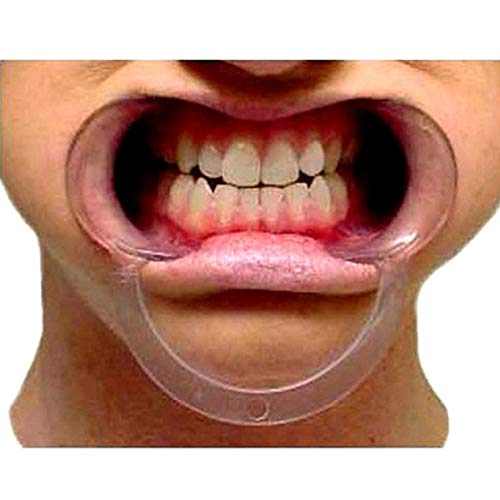 15 pcs Speak Out Dental Cheek Retractor Watch Ya Mouth Game C Adult Kids Teeth Whitening Mouth Opener (S) image 4