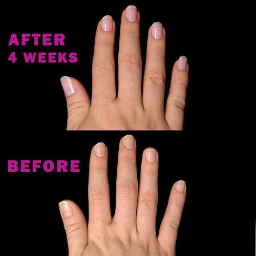 Perfect Formula Nail Essentials Kit – 4-Piece Keratin Nail Strengthener and Growth - Nail Repair For Damaged Nails | High Gloss Finish, Nail Polish and Treatment for Longer, Stronger Nails - Image 6