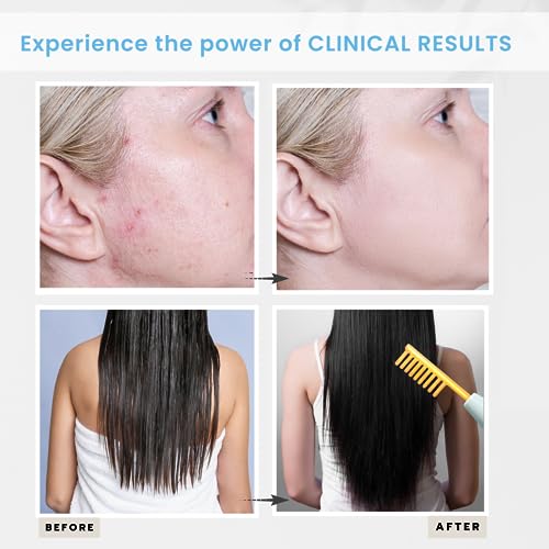 Pureyou DER-10 Dermati High Frequency Facial Machine- Portable Handheld High Frequency Facial Wand/Neon thumb #3