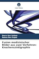 Fusion medizinischer Bilder aus zwei Verfahren: Knochenszintigraphie (German Edition) 6630435451 Book Cover