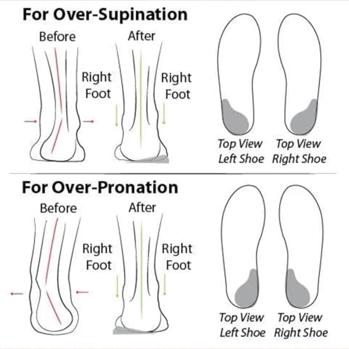 Sapatos ortopédicos femininos de malha macia e confortável, confortável para caminhada, suporte de a