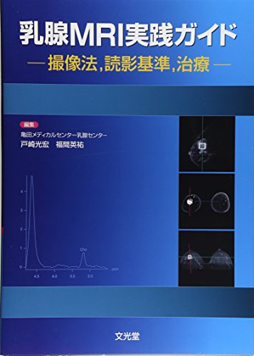 PDFダウンロード 乳腺MRI実践ガイド―撮像法、読影基準、治療 バイ