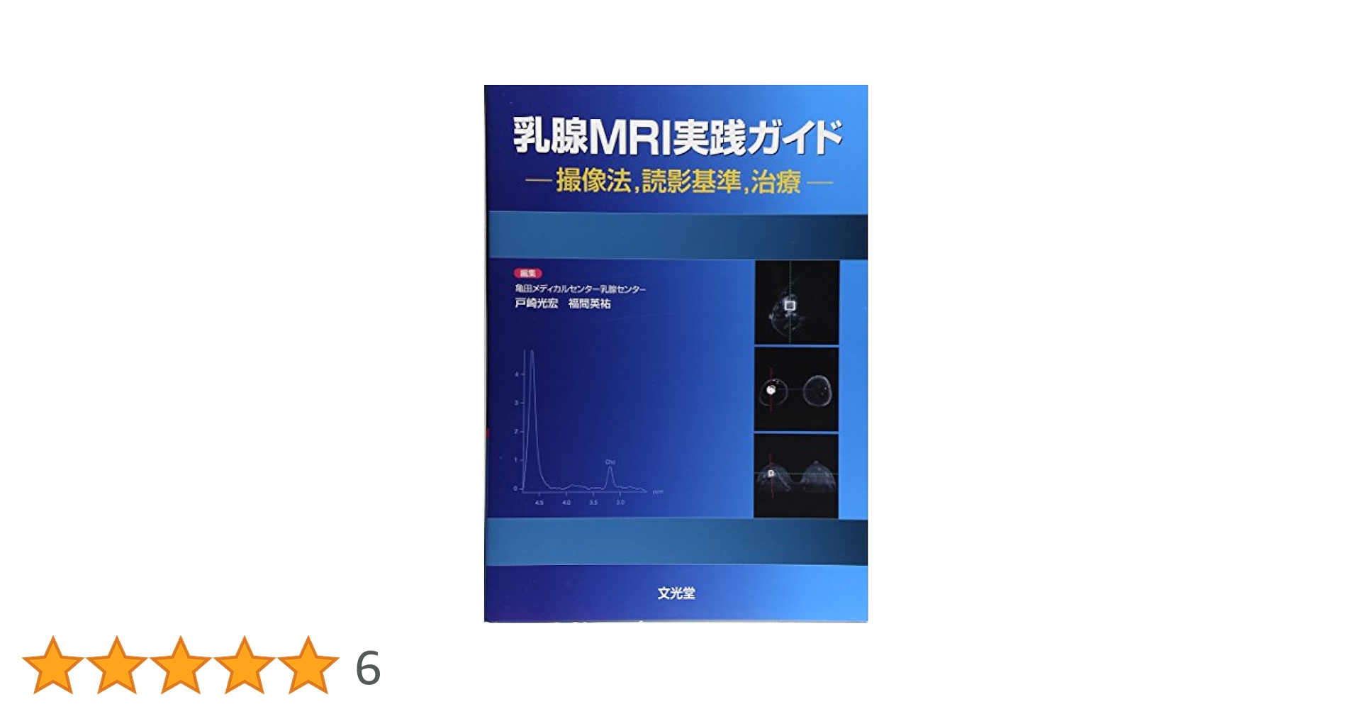 乳腺MRI実践ガイド: 撮像法読影基準治療 乳腺MRI実践ガイド