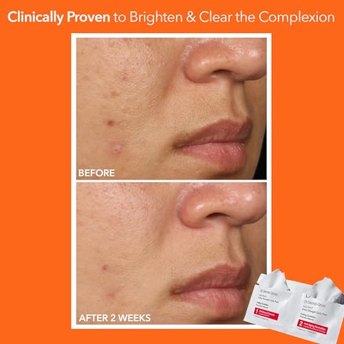 What is the Best Product to Remove Blackheads on Nose? Expert-Backed Solutions for Clear Skin 12 Dr. Dennis Gross Alpha Beta Extra Strength Daily Peel: for Oily Skin, Uneven Tone or Texture, Wrinkles or Enlarged Pores (30 Treatments)