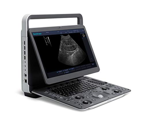 keebomed SonoScape E1V Veterinary Ultrasound with one Rectal Probe L741V