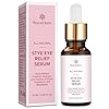 Roycederm Stye Eye Treatment Serum: Natural Stye Remover for Styes Chalazion and Blepharitis – Safe & Fast Relief
