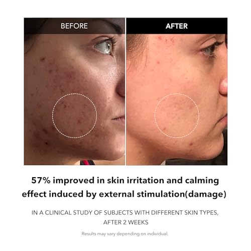 Image of APRILSKIN Carrotene Clarifying Facial Serum | Vegan, Non-comedogenic | Blemish Clear, Dark Spot Corrector | Korea Skincare | Oily Skin, Sensitive Skin, Bumpy Skin | 1.25 fl.oz