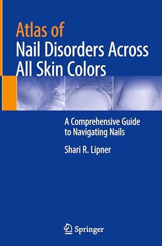 Atlas of Nail Disorders Across All Skin Colors: A Comprehensive Guide to Navigating Nails