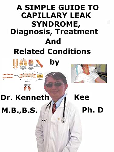 A Simple Guide To Capillary Leak Syndrome, Diagnosis, Treatment And Related Conditions (English Edition)