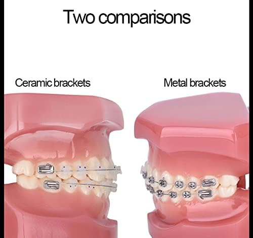 Modelli di Denti per Studenti di Odontoiatria, Modello Dentale Modello Ortodontico con Apparecchi in Ceramica E Metallo, Ottimo per L'insegnamento Scolastico E L'apprendimento degli Studenti, Mate