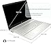 HP Laptop | 15.6
