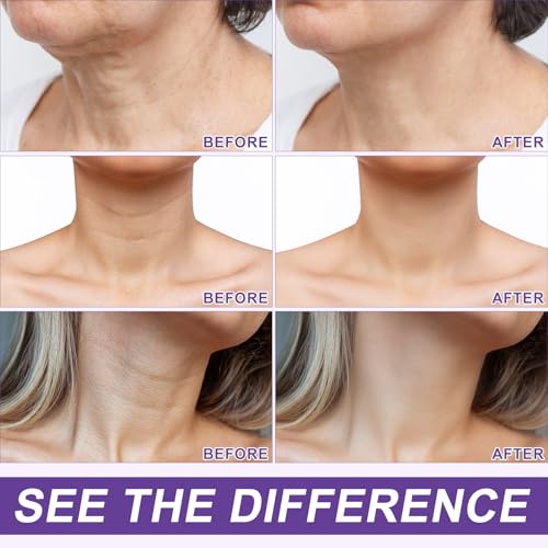 ZIXAOK AH-8 Firming Neck Cream for Crepey Skin Body Care Comfort, Neck Firming Cream with Roller, Moisturizing Tightening Lotions Cosmetic Skin Care Skin Repair for Women