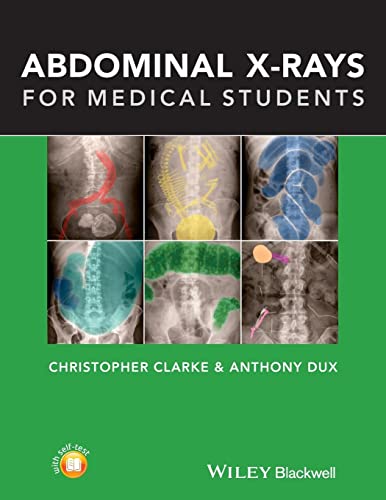  Abdominal X-rays for Medical Students