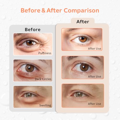 Image of 4PCS Gel Eye Ice Pack Set, Cold & Hot Compress, Reusable Cooling Gel Pads for Strain Relief, Relaxation, SPA and sleep(Oranges)