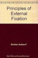 Principles of External Fixation 0683010654 Book Cover