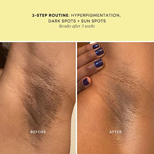 Bushbalm Dark Spot Treatment Oil - Smooths And Hydrates Skin, Helps Dark Spots And Uneven Skin Tone - Pina Colada, 30Ml (New Scent) #TOP5