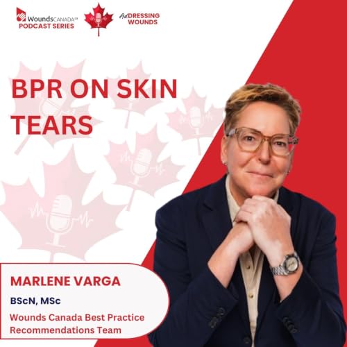 BPR ON SKIN TEARS
