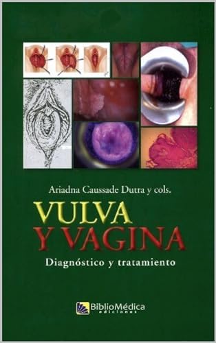 VULVA Y VAGINA: Diagnóstico y tratamiento (BIBLIOMÉDICA DIGITAL) (English Edition