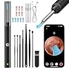 Ear Wax Removal, Ear Cleaner Ear Wax Removal Kit, 1296P HD Endoscope with 6 LED Lights, Kids Adults Ear Cleaning Gift, Compatible with iPhone & Android Smart Phones
