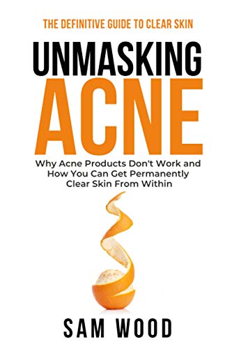 Unmasking Acne: The Definitive Guide to Clear Skin: Why Acne Products Donâ€™t Work and How You Can Get Permanently Clear Skin from Within