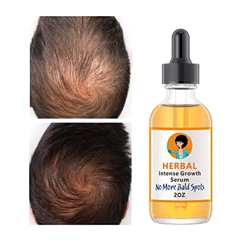 YAFUSIPE Ginger Hair Growth Serum Cover