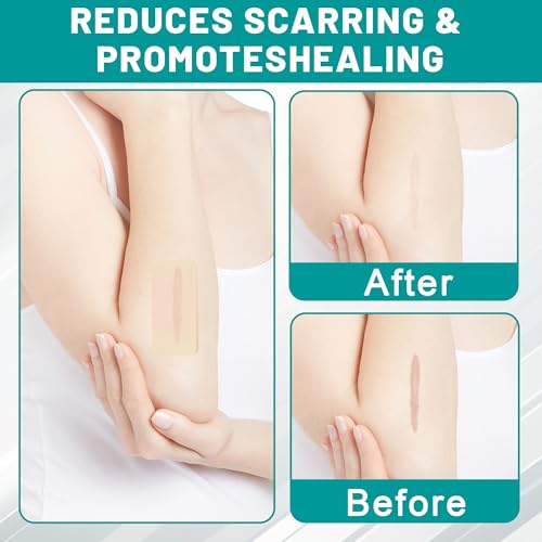 Hydrokolloid Pflaster Rolle, 5cm x 180cm Hydrokolloid Pflaster – Stark Saugfähig, Selbstklebend, Flexibel & Wasserdichter Hydrocolloid Roll, Haushaltsgrundlage