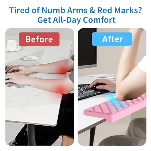Image of MEKASS L-Shaped Desk Elbow Pad for Desk, Memory Foam Elbow Support Padding with Non-Slip, Ergonomic Desk Edge Cushion, Wrist Comfort Support for Office Home 2 Pcs (Diamond Pink)