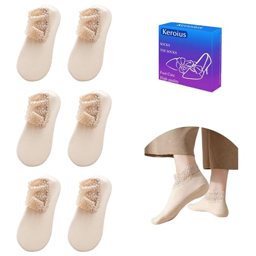 Image of 3Pairs Ruffle Lace Socks for Women Casual Ankle Knit Cotton Frilly Sock Breathable Knit Non-Slip Low Cut Crew Socks