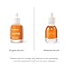 AROMATICA Organic Rosehip Oil 1.01oz / 30ml, Ecocert Certified, Vegan | 100% Natural and Organic | For All Skin Types