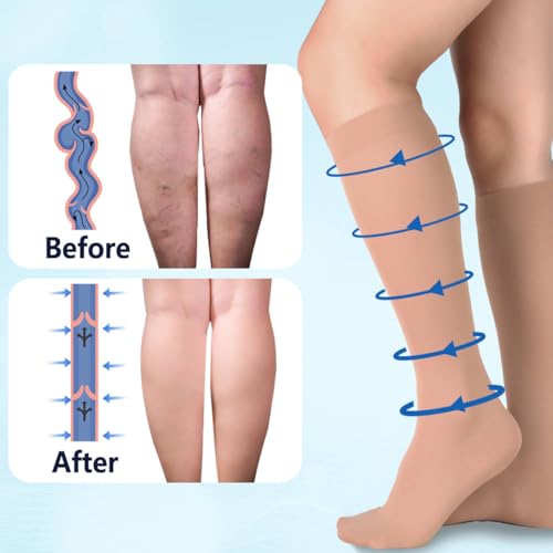 Image of +MD 15-20 mmHg Medical Compression Socks for Men /Women, Lightweight Opaque Knee High Support Stockings