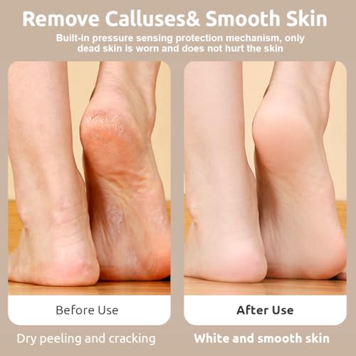 Image of HANNEA Electric Foot Callus Remover 3 Speeds USB Rechargeable Feet Scrubber Dead Skin Remover Cute Electric Foot File with 3 Interchangable Grinding Pads Travel