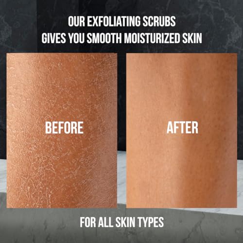 White Naturals Organic Activated Charcoal Face & Body Scrub, Exfoliating, Detoxifying, Skin Cell Renewal, Fine Line Treatment, Jar, 10 oz