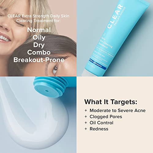 Paula’s Choice Clear Daily Skin Clearing Treatment With Benzoyl Peroxide For Facial Acne And Redness Relief, 2.25 Fl. Oz. (Extra Strength) #TOP3