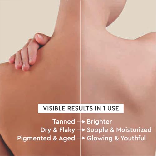 Image of Mintree Olive Body Lotion, 48-Hour Hydration with Ceramides and Peptides, Lightweight, Non-Sticky Body Lotion for Men and Women, Helps Calm Body Acne and Protect from Pollution | All Skin Types | 200 ml