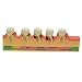 Easyinsmile Periodontal Disease Assort Tooth Typodont Model Study Teaching Teeth Model