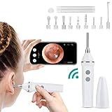 Camfosy Otoskop Ohr Endoskop Schwarz, Weiß, Rosa