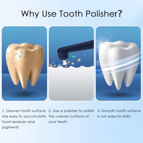 Zahnaufhellungsset, Wbbrbbr Zahnpolierer mit 4 Modi für Zahnreinigung & Zähne Aufhellen, zum Polieren nach der Zahnreinigung, Zahnaufhellung Bleaching Set mit 5 Köpfen und 3 Polierpasten (Blau) – Bild 7